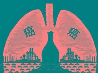 哪些癌癥可以通過早期癌癥篩查發現? 哪些癌癥可以通過早期癌癥篩查發現?